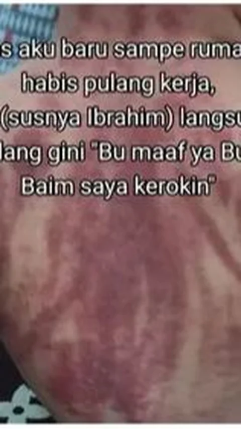 Dalam dunia kedokteran, kerokan masih menjadi hal yang kontroversial. Kemerahan yang terjadi pada kulit akibat kerokan sebenarnya disebabkan oleh melebarnya atau pecahnya pembuluh darah kecil di kulit akibat digores oleh uang koin. 