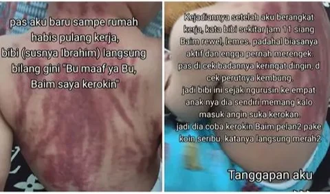 Untuk merawat anak saat sakit, ada cara lain yang lebih efektif yang dapat ditempuh oleh orangtua. Kerokan sebaiknya tidak dijadikan pilihan utama.