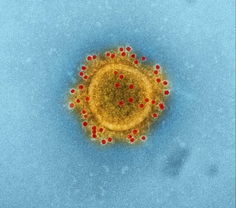 Geger Virus Nipah, Ini Gejala dan Cara Mencegahnya