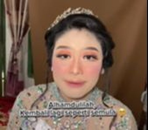 Makeup Pengantin Rusak karena Masuk Angin, Potret Wajahnya Bikin MUA Auto Nangis