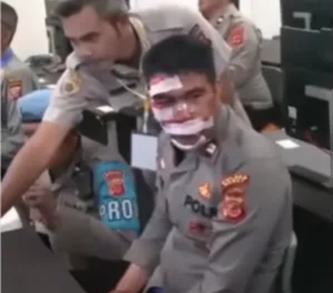 Muka Bonyok Penuh Luka dan Perban, Bintara Polri ini Gigih Ikut Tes Perwira, Hasilnya di Luar Dugaan