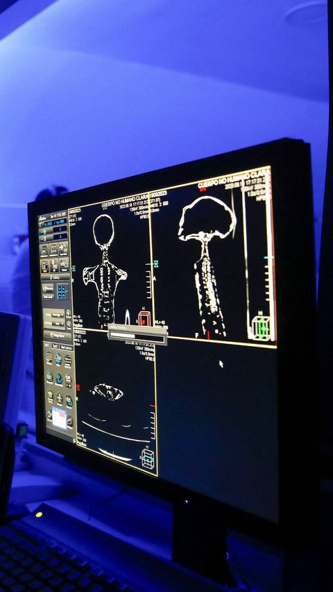 Dari pemeriksaan yang tertuang pada layar monitor didapat penampakan visual yang memperlihatkan kondisi struktur rangka dari mumi alien tersebut.