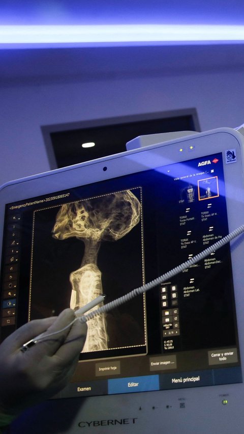 FOTO: Melihat Para Peneliti Meksiko Periksa Dua Tubuh Mumi Alien Menggunakan Alat CT Scan
