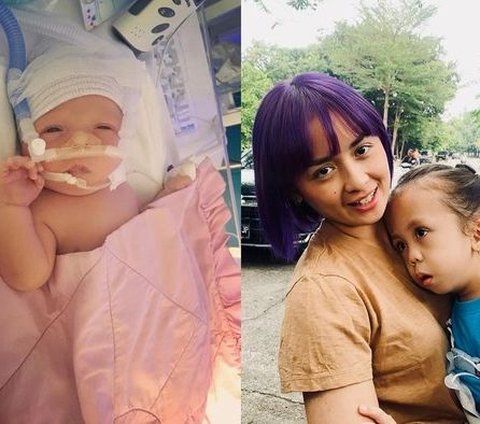 Dirawat Penuh Kasih Sayang dan Penuh Perjuangan, Ini Deretan Potret Anak Artis Yang Berkebutuhan Khusus