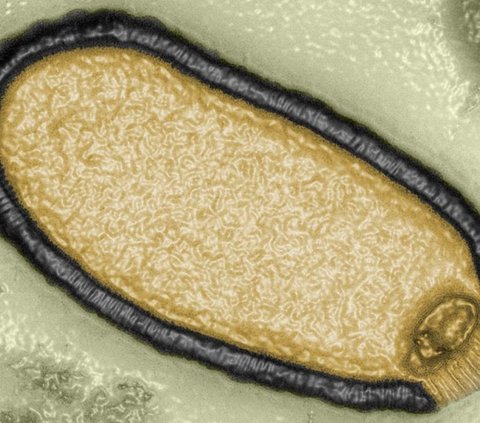 Heboh Virus Nipah, Kemenkes Ungkap Kondisi WNI di India