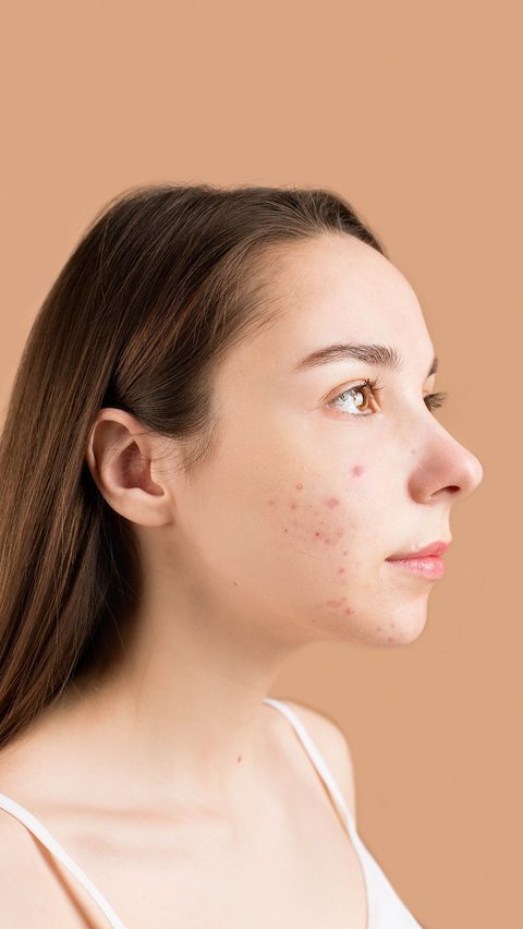 5 Ciri-ciri Skincare Tidak Cocok di Kulit yang Jarang Disadari, Kenali Tandanya