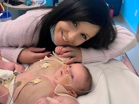 Viral! Photos of Premature Babies with Large Chest and Arms, Dubbed 'Baby Hulk'