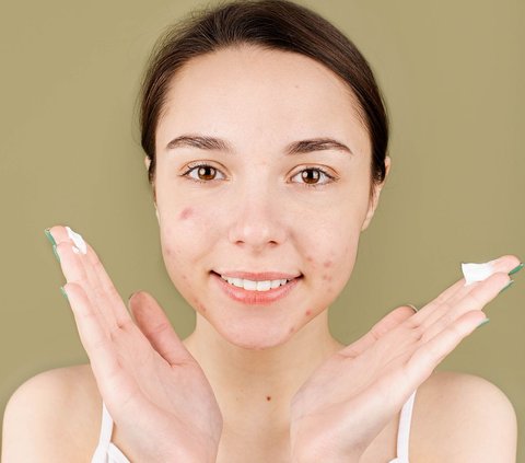 5 Steps to Reduce Acne-Causing Oil in the T-Zone