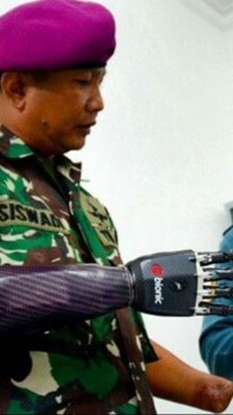 Prajurit TNI AL Ini Memiliki Lengan 'Robot' Bionic, Pernah Kehilangan Tangan Karena Granat<br>