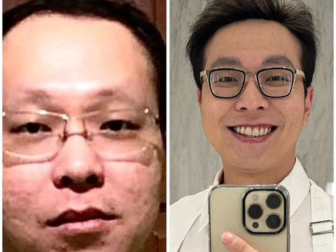 Transformation of Dr. Richard Lee, See the Real Face He Called Shameful Photo