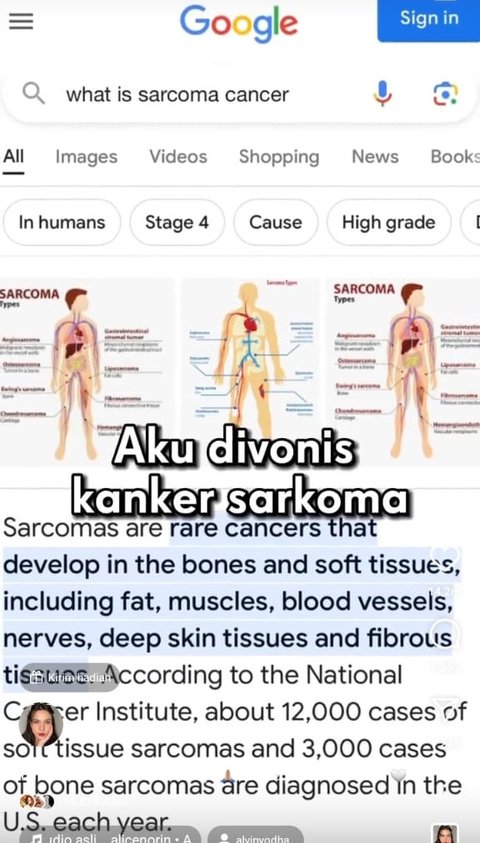 Kanker Sarkoma merupakan sebuah jenis kanker yang cukup langka dan berkembang di otot rahim.