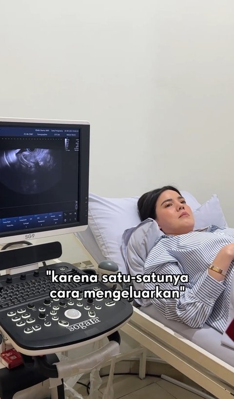 Potret Alice Norin Jalani Perawatan Hingga Operasi Kanker Sarkoma di Singapura, Sempat Bingung Pilih Metode Operasinya