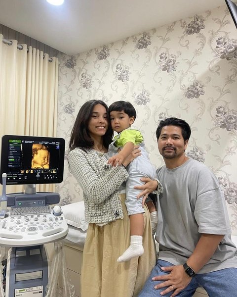 Selamat! Vanessa dan Erick Iskandar Dikaruniai Anak Kedua, Bayinya Menggemaskan Kayak Boneka