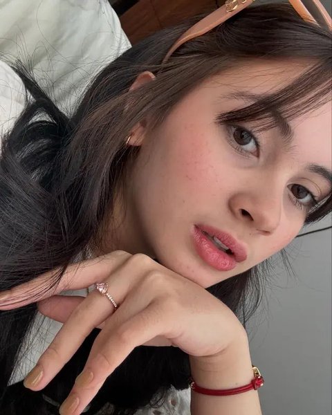 Potret Richelle Skornicki Adik Sandrinna Michelle Tampil Bare Face, Tetap Cantik dan Percaya dengan Freckles