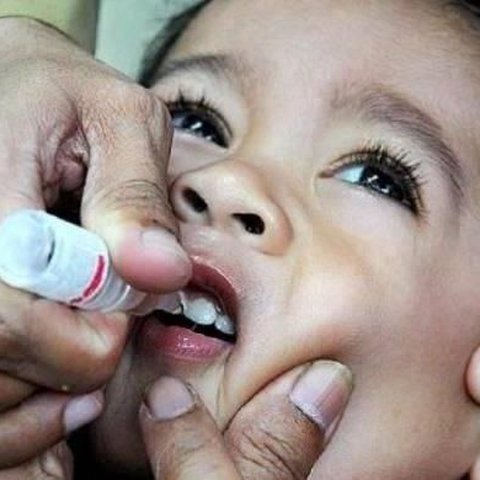 Kenali Perbedaan Kelumpuhan Akibat Polio dan TBC Tulang serta Cara Pencegahannya