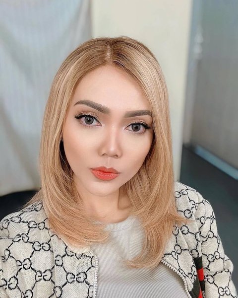 Blak-blakan, Rina Nose Berencana Jalani Operasi Plastik, Ada Perbedaan di Bagian Rahang