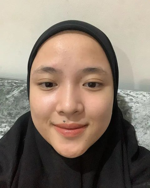 Potret Nissa Sabyan Pede Pamer Foto Berjerawat (Sumber: Instagram/nissa_sabyan)