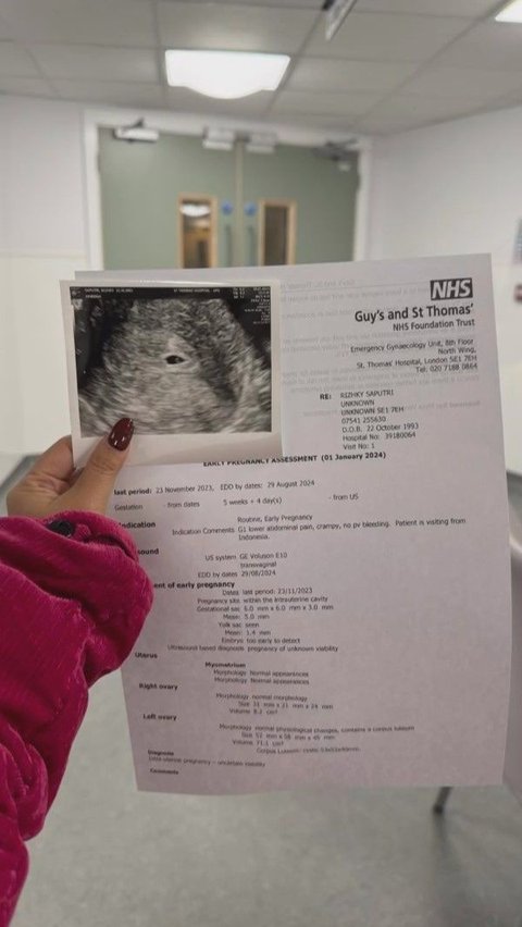 When in London, Kiky had her pregnancy checked.