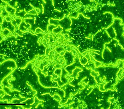 This 1.75 Billion Year Old Fossil Proves Photosynthesis Evolved