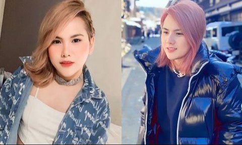 Potret dan Kabar Terbaru Evelyn Nada Anjani Mantan Istri Aming, Dulu Pernah Suntik Hormon