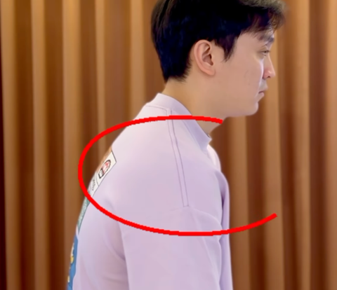 Doctor Reveals 3 Signs of a Hunched Posture Body, Check in the Mirror Immediately