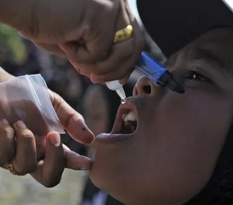 Kondisi Terkini Anak Kena Polio di Klaten