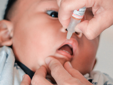 Dokter Ungkap Penyebab Anak Rentan Kena Polio