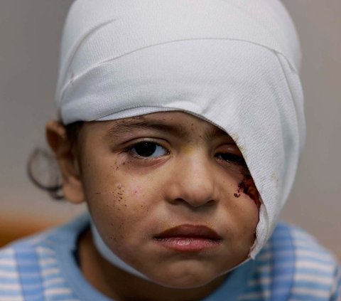FOTO: Potret Memilukan Warga Jalur Gaza Lebih dari 100 Hari Dibombardir Israel