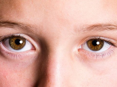 Cara Mencegah Infeksi Mata