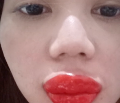Not Becoming Beautiful, TikToker's Lips Look Strange After Embroidery