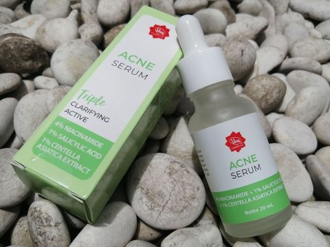 Get Rid of Stubborn Acne Without Drying Out Your Skin with Active Ingredient Serum