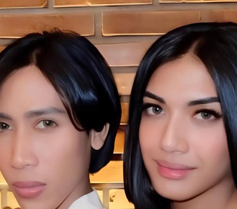 8 Transformations of Aby Respati, Millen Cyrus' Friend, from Being a Transgender to Taking Birth Control Pills, Now Marrying a Beautiful Woman