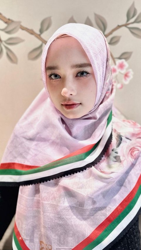 Inara Rusli Responds to the Issue of Removing Hijab: 'She Knows Hair Color Best'