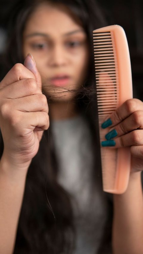 Cari Tahu Apa Saja Penyebab Kebotakan Rambut di Usia Muda, Nomor 3 Paling Sering Dilakukan!