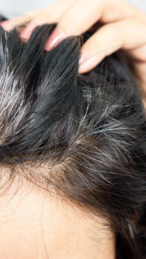 Grey Hair Grows at a Young Age? Maybe This is the Cause