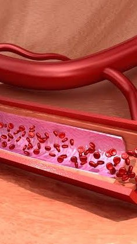 Perbedaan Arteri dan Vena, Pahami agar Bisa Tahu saat Terjadi Gangguan di Keduanya <br>