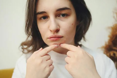 Ilustrasi Masalah Kulit Wajah Credit: pexels.com/Youra