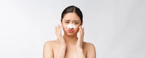 ilustrasi jerawat/copyright freepik/wayhomestudio