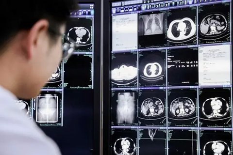 Lembaga riset Alibaba, DAMO Academy menggunakan teknologi artificial intilligence (AI) dalam mengembangkan alat untuk mendeteksi kanker. (Dok Alibaba)