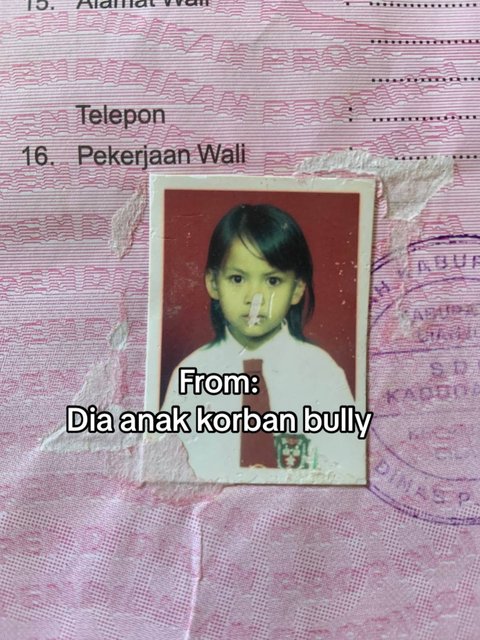 Bangkit dari Keterpurukan, Kisah Wanita yang Dulunya Sempat Jadi Korban Bully saat Sekolah Ini Banjir Pujian Warganet