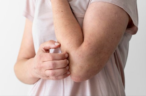 penyebab iritasi pada kulit sensitif