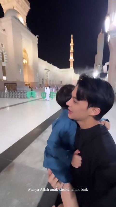 7 Potret Terbaru Rey Mbayang yang Benarkan Oplas Hidung, Alasannya Masalah Kesehatan