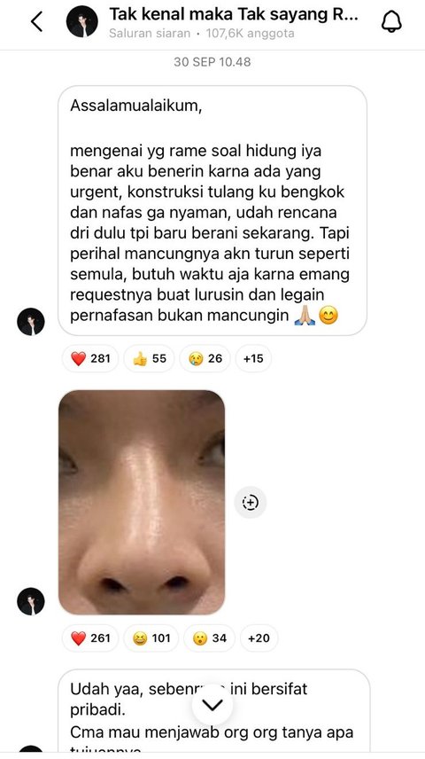 7 Potret Terbaru Rey Mbayang yang Benarkan Oplas Hidung, Alasannya Masalah Kesehatan