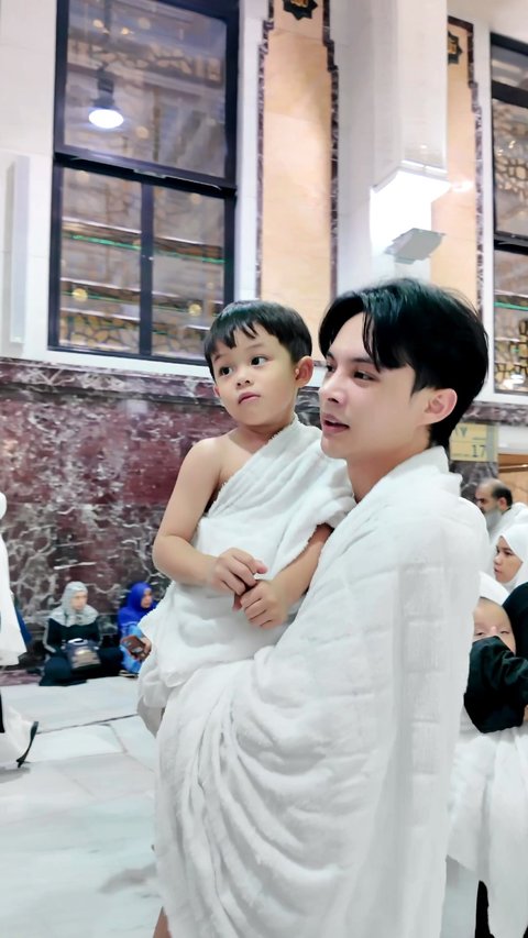 7 Potret Terbaru Rey Mbayang yang Benarkan Oplas Hidung, Alasannya Masalah Kesehatan