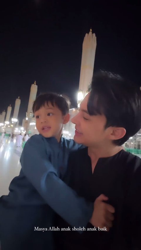 7 Potret Terbaru Rey Mbayang yang Benarkan Oplas Hidung, Alasannya Masalah Kesehatan