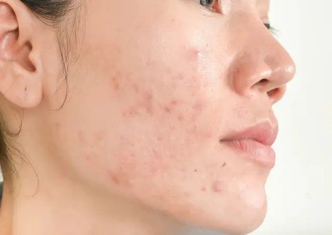 ilustrasi masker oatmeal dan yoghurt/unsplash