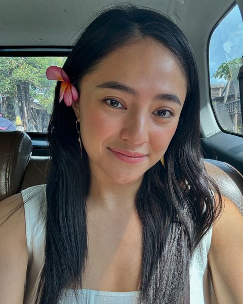 Marshanda Tegaskan Ogah Operasi Plastik, Ini Alasannya