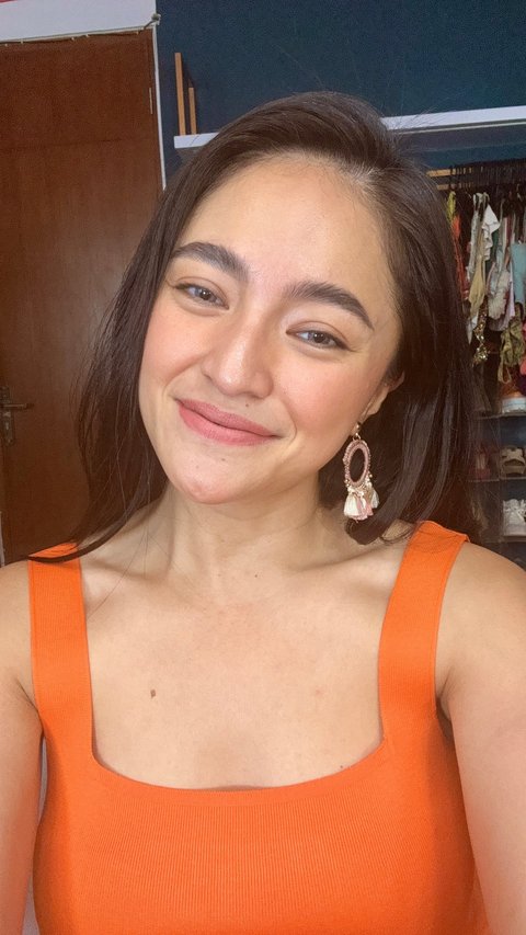 Marshanda Tegaskan Ogah Operasi Plastik, Ini Alasannya