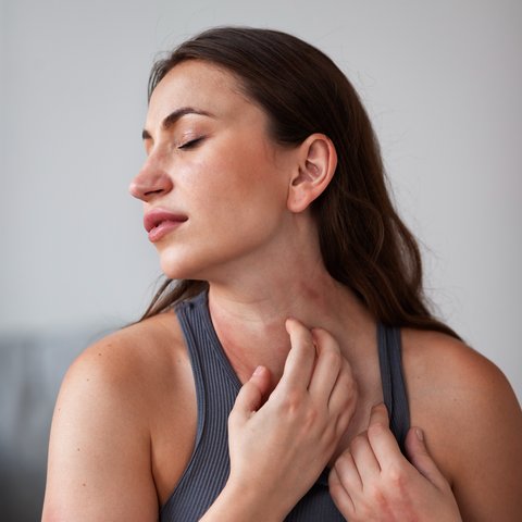 Gejala Alergi Makanan