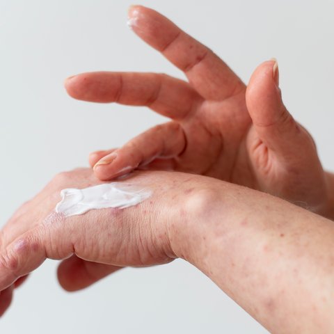 Penanganan Reaksi Alergi